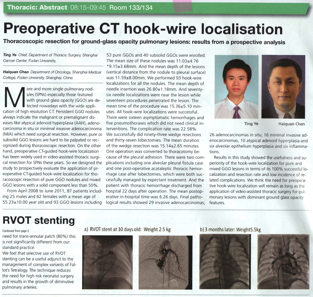 Preoperative CT hook-wire localisation